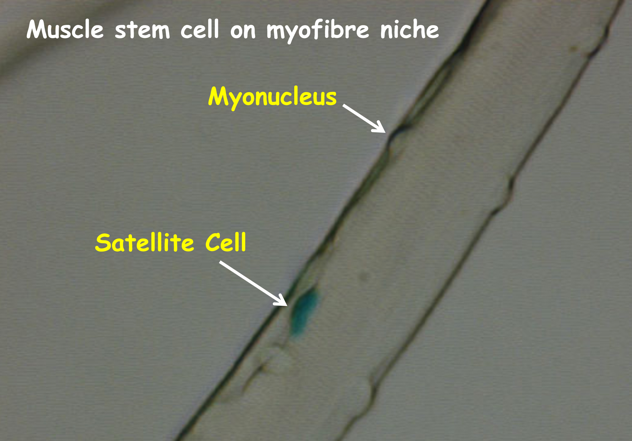 Satellite cells are vital for muscle repair and replacement Eurostemcell